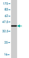 Western blot against tagged recombinant protein immunogen using ab57634 KCNQ5 antibody at 1ug/ml.