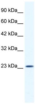 Anti-KCTD11 antibody (ab33059) at 1.25 µg/ml + HepG2 cell lysate at 10 µgSecondaryHRP conjugated anti Rabbit IgG at 1/50000 dilution