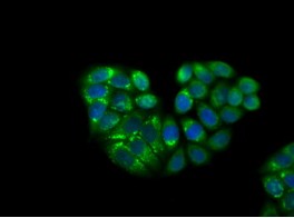 ab118145, at a 1/100 dilution, staining KCTD5 in HeLa cells by Immunofluorescence.
