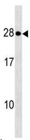 Anti-KDEL Receptor antibody - C-terminal (ab138921) at 1/100 dilution + MCF7 cell lysate at 35 µg