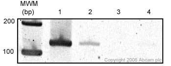      ab17721 at a 1/100 dilution in cross-linking ChIP (using formaldehyde) with mouse liver tissue lysate. The protocol from Nguyen, T. T, et al. (2005) Mol. Cell. Biol. 25: 2147-2157 was followed. Semiquantitative PCR was used as the detection step. Lane 1: InputLane 2: ab17721Lane 3: IgGLane 4: No abThis image is courtesy of an Abreview by  Michelle Barton.See Abreview