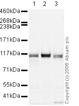 All lanes : Anti-KDM1 / LSD1 antibody - ChIP Grade (ab17721) at 1 µg/mlLane 1 : HeLa (Human epithelial carcinoma cell line) Whole Cell Lysate Lane 2 : Jurkat (Human T cell lymphoblast-like cell line) Whole Cell Lysate (ab7899)Lane 3 : NIH 3T3 (Mouse embryonic fibroblast cell line) Whole Cell Lysate (ab7179)Lysates/proteins at 20 µg per lane.SecondaryGoat polyclonal to Rabbit IgG H&L (HRP) Pre-Adsorbed at 1/10000 dilutionPerformed under reducing conditions.
