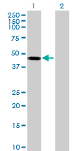 All lanes : Anti-Keratin 36 antibody (ab69832) at 1/500 dilutionLane 1 : Keratin 36 transfected 293T cell lysateLane 2 : Non transfected 293T cell lysateLysates/proteins at 25 µg per lane.SecondaryGoat Anti-Mouse IgG (H&L)-HRP Conjugate at 1/2500 dilution