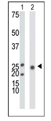 All lanes : Anti-ketohexokinase antibody (ab38282) at 1/100 dilutionLane 1 : Mouse liver tissue lysate Lane 2 : 293 cell lysate