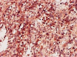 ketohexokinase antibody (ab55382) used in immunohistochemistry at 5ug/ml on formalin fixed and paraffin embedded human spleen tissue.