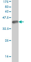 Western blot against tagged recombinant protein immunogen using ab58222 KF1 antibody at 1ug/ml.