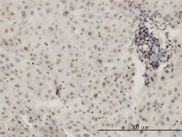 KHSRP antibody (ab56438) used in immunohistochemistry at 3ug/ml on formalin fixed and paraffin embedded human liver.