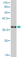 Western blot against tagged recombinant protein immunogen using ab56438 KHSRP antibody at 1ug/ml. 
