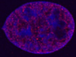 This image was kindly supplied as part of the review submitted by Dr Geza Fejes-Toth.