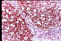 ab833 - immunohistochemistry Formalin fixed paraffin embedded human tonsil stained with Ki-67, using ABC and AEC chromogen.
