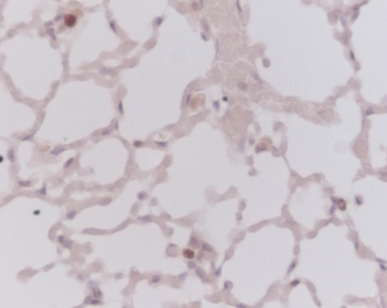 This picture was kindly supplied as part of the review submitted by Dr Robert O'Donogue. Tissue sections from mouse lung were stained with ab833 at a dilution of 1/50.