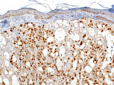 HT-29 xenograft tumor in mouse 20x pretreatment w/ citrate pH 6.0 using anti-Ki67 antibody ab833 at 5 ug/mL for 30 min at RT.