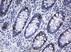 Immunohistochemical analysis of paraffin-embedded Human colon tissue labeling Ki67 with ab156956 at 1/150 dilution.