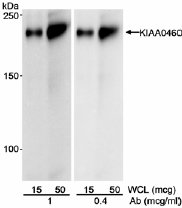 Lanes 1 - 2 :  Anti-KIAA0460 antibody (ab17996) at 1 µg/mlLanes 3 - 4 :  Anti-KIAA0460 antibody (ab17996) at 0.4 µg/mlLane 1 : Whole cell lysate from HEK239 cells at 15 µgLane 2 : Whole cell lysate from HEK239 cells at 50 µgLane 3 : Whole cell lysate from HEK239 cells at 15 µgLane 4 : Whole cell lysate from HEK239 cells at 50 µg