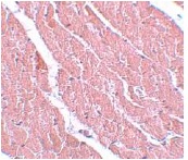 Immunohistochemistry of KIAA0652 in Mouse heart, using ab105392 at a dilution of 5 µg/ml.