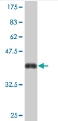Anti-KIAA1199 antibody (ab76849) at 5 µg/ml + immunogen at 0.2 µgSecondaryGoat Anti-Mouse IgG (H&L)-HRP Conjugate at 1/5000 dilutiondeveloped using the ECL technique