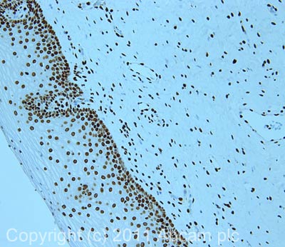 IHC image of ab40975 staining in cervix formalin fixed paraffin embedded tissue section, performed on a Leica BondTM system using the standard protocol F. The section was pre-treated using heat mediated antigen retrieval with sodium citrate buffer (pH6, epitope retrieval solution 1) for 20 mins. The section was then incubated with ab40975, 5µg/ml, for 15 mins at room temperature and detected using an HRP conjugated compact polymer system. DAB was used as the chromogen. The section was then counterstained with haematoxylin and mounted with DPX.For other IHC staining systems (automated and non-automated) customers should optimize variable parameters such as antigen retrieval conditions, primary antibody concentration and antibody incubation times.