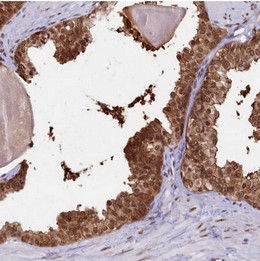 ab122425 at 1/3000 dilution staining KIAA1598 homolog in Paraffin-embedded Human prostate tissue by Immunohistochemistry.