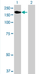 All lanes : Anti-KIAA1618 antibody (ab71892) at 1/500 dilutionLane 1 : KIAA1618 transfected 293T cell lysateLane 2 : Non-transfected 293T cell lysateLysates/proteins at 25 µg per lane.SecondaryGoat anti-mouse IgG (H&L) HRP conjugate at 1/2500 dilution