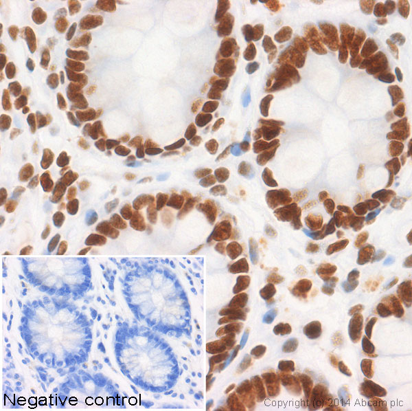 IHC image of ab40883 staining Histone H2B (acetyl K12) in human colon formalin fixed paraffin embedded tissue sections, performed on a Leica Bond. The section was pre-treated using heat mediated antigen retrieval with sodium citrate buffer (pH6, epitope retrieval solution 1) for 20 mins. The section was then incubated with ab40883, 1/200 dilution, for 15 mins at room temperature and detected using an HRP conjugated compact polymer system. DAB was used as the chromogen. The section was then counterstained with haematoxylin and mounted with DPX. No primary antibody was used in the negative control (shown on the inset).For other IHC staining systems (automated and non-automated) customers should optimize variable parameters such as antigen retrieval conditions, primary antibody concentration and antibody incubation times.