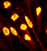 ab40883 (1:250) staining of HeLa cells by immunofluorescence.