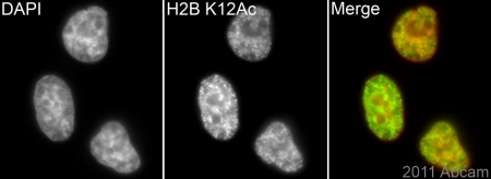 ab40883 (1/500) staining Histone H2B (acetyl K12) in assynchronous HeLa cells (green). Cells were fixed with paraformaldehyde, permeabilised using 0.5% Triton X100 and counterstained with DAPI in order to highlight the nucleus (red). For further experimental details please refer to Abreview.See Abreview