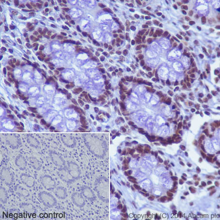 Immunohistochemical analysis of paraffin-embedded Human colon tissue labeling Histone H2B (acetyl K16) with ab177427 at 1/2000 dilution, followed by Goat Anti-Rabbit IgG H&L (HRP) (ab97051) secondary antibody at 1/500 dilution. Nucleus staining on glandular epithelium of Human colon tissue is observed. Counter stained with Hematoxylin.Negative control: Uses PBS instead of primary antibody, secondary antibody is Goat Anti-Rabbit IgG H&L (HRP) (ab97051) at 1/500 dilution.