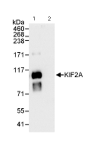 Detection of Human Kif2a by Immunoprecipitation in Whole cell lysate from HeLa cells (1 mg for IP, 20% of IP loaded) using ab71160 at 3 µg/mg lysate for IP (Lane 1) and at 0.1 µg/ml for subsequent WB detection. Lane 2 represents control IgG IP.