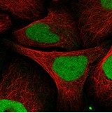 Immunofluorescent staining of human cell line U-2 OS shows positivity in nucleus but not nucleoli using ab122227.Recommended conditions: Fixation/Permeabilization: PFA/Triton X-100