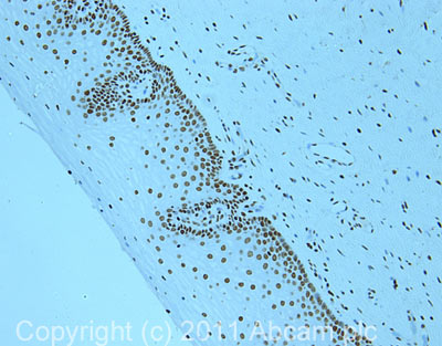 IHC image of ab40977 staining in cervix formalin fixed paraffin embedded tissue section, performed on a Leica BondTM system using the standard protocol F. The section was pre-treated using heat mediated antigen retrieval with sodium citrate buffer (pH6, epitope retrieval solution 1) for 20 mins. The section was then incubated with ab40977, 5µg/ml, for 15 mins at room temperature and detected using an HRP conjugated compact polymer system. DAB was used as the chromogen. The section was then counterstained with haematoxylin and mounted with DPX.For other IHC staining systems (automated and non-automated) customers should optimize variable parameters such as antigen retrieval conditions, primary antibody concentration and antibody incubation times.