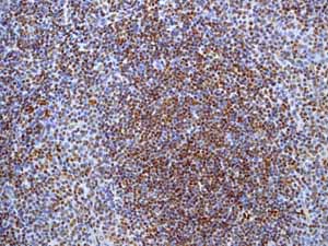 ab52988 showing positive staining in Normal tonsil tissue.