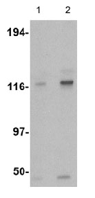 Lane 1 :  Anti-Kinesin 5 A + B + C antibody (ab62105) at 0.5 µg/mlLane 2 :  Anti-Kinesin 5 A + B + C antibody (ab62105) at 1 µg/mlLane 1 : K562 cell lysateLane 2 : K562 cell lysate