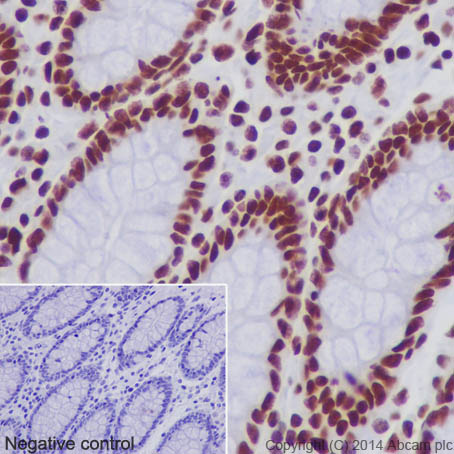 Immunohistochemical analysis of paraffin-embedded Human colon tissue labeling Histone H2B (acetyl K20) with ab177430 at 1/1000 dilution, followed by Goat Anti-Rabbit IgG H&L (HRP) (ab97051) at 1/500 dilution. Nucleus staining on Human colon is observed. Counter stained with Hematoxylin.Negative control: Using PBS instead of primary antibody.