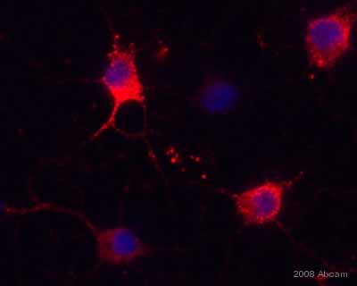 ab11883 staining rat neuronal stem cells by ICC/IF.  Cells were PFA fixed and permeabilized in 0.5% Saponin, prior to blocking with 10% serum for 1 hour at 21°C.  The primary antibody was diluted 1/500 with PBS + 1% FCS and incubated with the sample for 18 hours at 4°C.  A Cy5® conjugated goat anti-mouse IgG antibody was used as the secondary.See Abreview