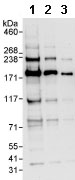 All lanes : Anti-Kinetochore antibody (ab85996) at 0.04 µg/mlLane 1 : HeLa whole cell lysate at 50 µgLane 2 : HeLa whole cell lysate at 15 µgLane 3 : HeLa whole cell lysate at 5 µgdeveloped using the ECL technique