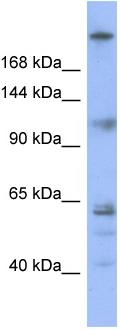 Anti-Kinetochore antibody (ab97841) at 1 µg/ml (in 5% skim milk / PBS buffer) + OVCAR3 cell lysate at 10 µgSecondaryHRP conjugated anti-Rabbit IgG at 1/50000 dilution
