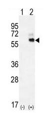 All lanes : Anti-Kininogen 1 antibody (ab170475) at 1/100 dilutionLane 1 : 293 cell lysate, non-transfectedLane 2 : 293 cell lysate, transiently transfected with Kininogen 1Lysates/proteins at 2 µg per lane.