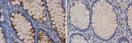 ab65796 staining Kir2.1 in human colon.Left panel: with primary antibody at 1:1000 dilution. Right panel: isotype control.Sections were stained using an automated system (DAKO Autostainer Plus ), at room temperature: sections were rehydrated and antigen retrieved with the Dako 3 in 1 AR buffers citrate pH6.1 in a DAKO PT link. Slides were peroxidase blocked in 3% H2O2 in methanol for 10 mins. They were then blocked with Dako Protein block for 10 minutes (containing casein 0.25% in PBS) then incubated with primary antibody for 20 min and detected with Dako envision flex amplification kit for 30 minutes. Colorimetric detection was completed with Diaminobenzidine for 5 minutes. Slides were counterstained with Haematoxylin and coverslipped under DePeX. Please note that for manual staining we recommend to optimize the primary antibody concentration and incubation time (overnight incubation), and amplification may be required.