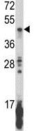 Anti-KIR2DL5B antibody (ab175895) at 1/1000 dilution + K562 cell line lysate at 35 µg