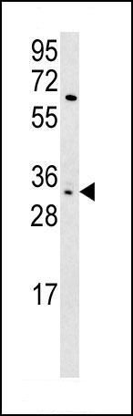 Anti-KIR2DS3 antibody - C-terminal (ab175529) at 1/1000 dilution + HL60 cell line lysate at 15 µgdeveloped using the ECL technique