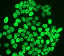 ab40886 (1:250) staining A431 cells by immunofluorescence.