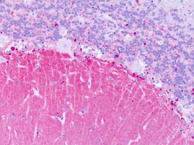 Immunohistochemical analysis of paraffin-embedded Human brain cerebellum tissue, labeling KiSS1 receptor with ab140839 at 14 µg/ml.