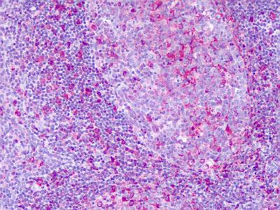 Immunohistochemical analysis of paraffin-embedded Human tonsil tissue, labeling KiSS1 receptor with ab140839 at 14 µg/ml.