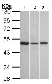 All lanes : Anti-KiSS1 receptor antibody (ab137483) at 1/1000 dilutionLane 1 : A431 whole cell lysateLane 2 : HeLa whole cell lysateLane 3 : HepG2 whole cell lysateLysates/proteins at 30 µg per lane.