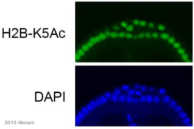 IHC - Wholemount of Caenorhabditis elegans larvae labelling Histone H2B (acetyl K5) with ab40886. The sample was incubated with primary antibody (1/200 in PBS + 3% BSA + 0.1% Triton X-100) for 12 hours at 4°C. ab150077, a goat anti-rabbit Alexa 488 (1/1000), was used as the secondary antibody.See Abreview