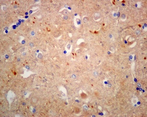 Immunohistochemical analysis of paraffin-embedded Human brain tissue labeling KLC1 with ab174273 at 1/50 dilution.