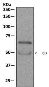 Western blot analysis on immunoprecipitation pellet from SH-SY5Y cell lysate using ab174273 at 1/10 dilution.