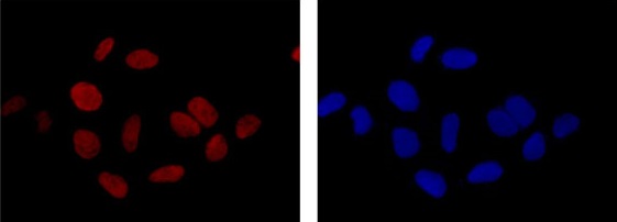 Immunofluorescence analysis of 4% paraformaldehyde fixed HEK293 cells, labeling KLF15 (red) with ab185958 at 1/500 dilution. Alexa Fluor®555-conjugated goat anti-rabbit IgG was used as a secondary antibody at 1/200 dilution. Nuclei were counterstained with DAPI (blue).
