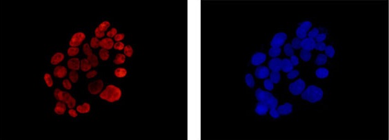Immunofluorescence analysis of 4% paraformaldehyde fixed HepG2 cells, labeling KLF15 (red) with ab185958 at 1/500 dilution. Alexa Fluor®555-conjugated goat anti-rabbit IgG was used as a secondary antibody at 1/200 dilution. Nuclei were counterstained with DAPI (blue).