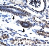 Immunohistochemical detection of HES7 using 4 ug/ml ab26062 in paraffin embedded human kidney tissue section. Arrows indicate positively labelled epithelial cells of the renal tubule.